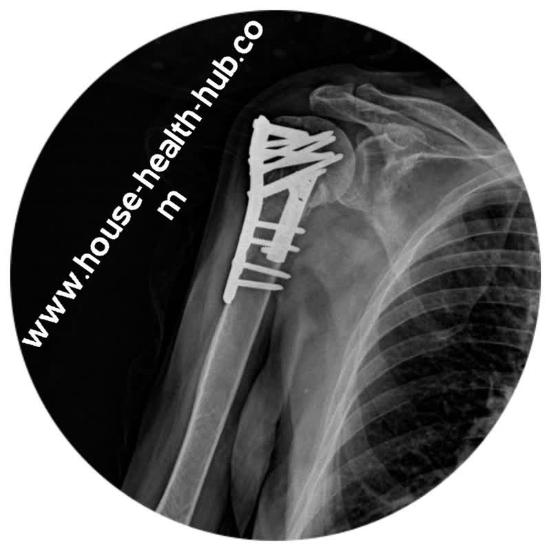 رادیولوژی در منزل کرج البرز از شانه بازو کتف