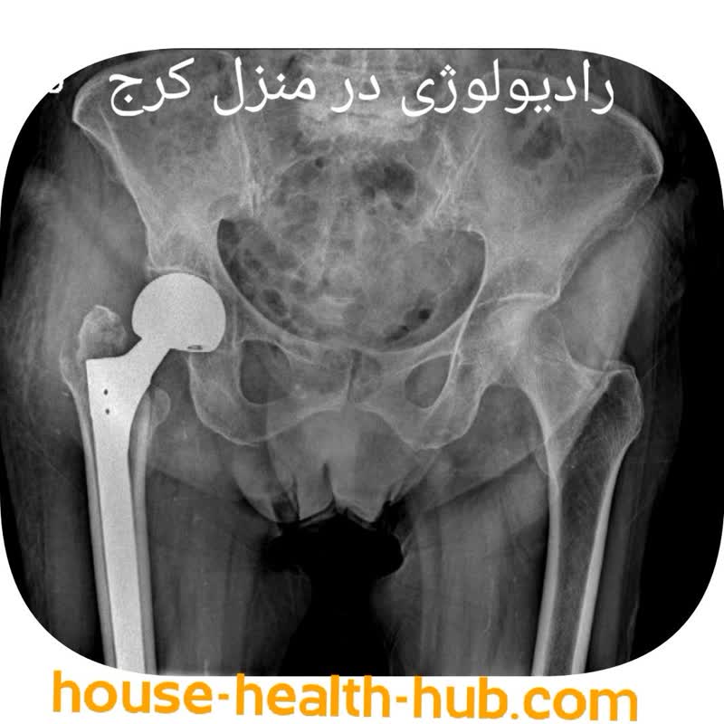 رادیولوگرافی یا رادیولوژی در منزل کرج البرز مهیار گراوند
